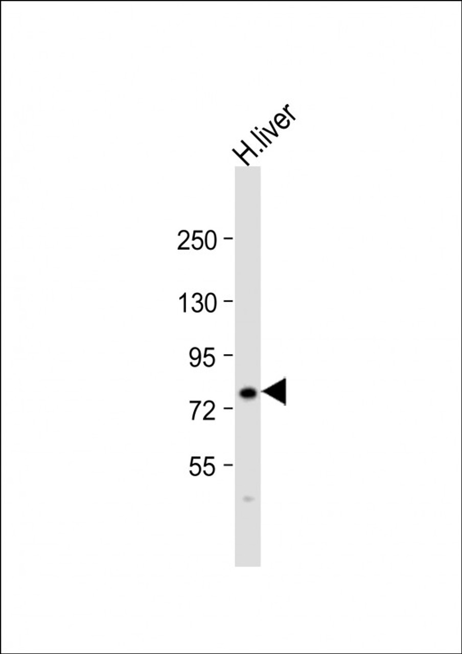 Western Blot at 1:1000 dilution + human liver lysate Lysates/proteins at 20 ug per lane.