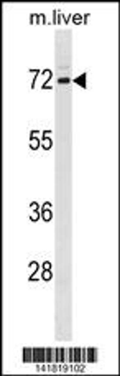 Western blot analysis in mouse liver tissue lysates (35ug/lane) .