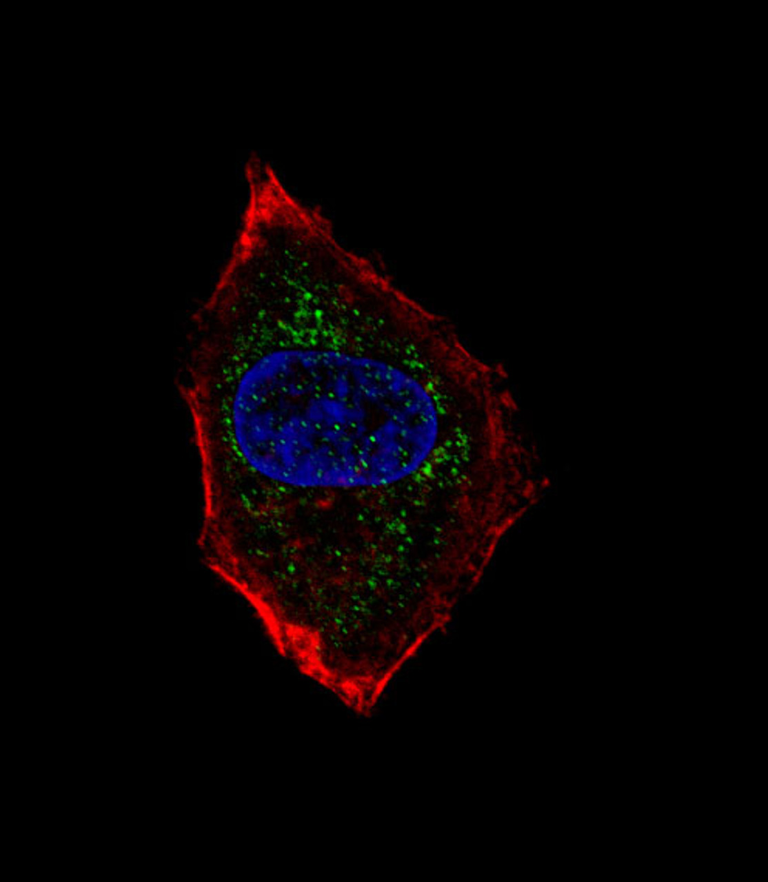 Fluorescent confocal image of HepG2 cell stained with hNeuroD1-Q30. HepG2 cells were fixed with 4% PFA (20 min) , permeabilized with Triton X-100 (0.1%, 10 min) , then incubated with hNeuroD1-Q30 primary antibody (1:25) . For secondary antibody, Alexa Fluor 488 conjugated donkey anti-rabbit antibody (green) was used (1:400) .Cytoplasmic actin was counterstained with Alexa Fluor 555 (red) conjugated Phalloidin (7units/ml) . Nuclei were counterstained with DAPI (blue) (10 ug/ml, 10 min) .hNeuroD1-Q30 immunoreactivity is localized to vesicles significantly.