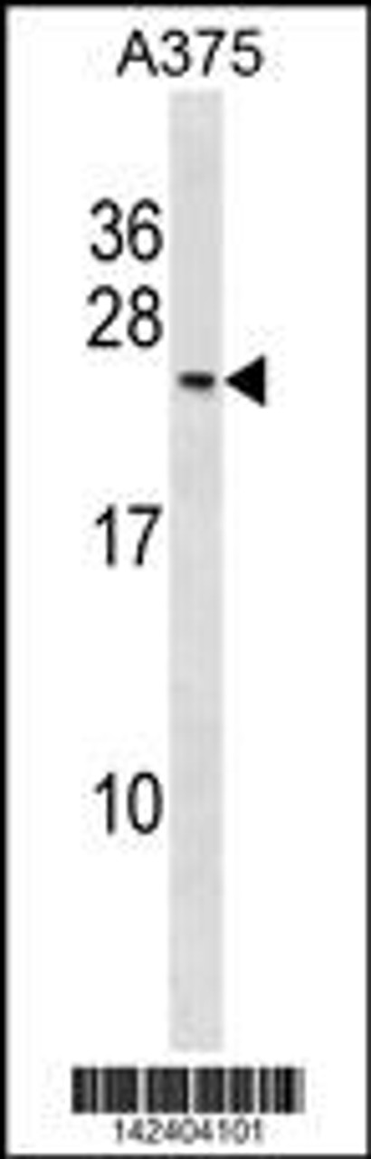 Western blot analysis in A375 cell line lysates (35ug/lane) .