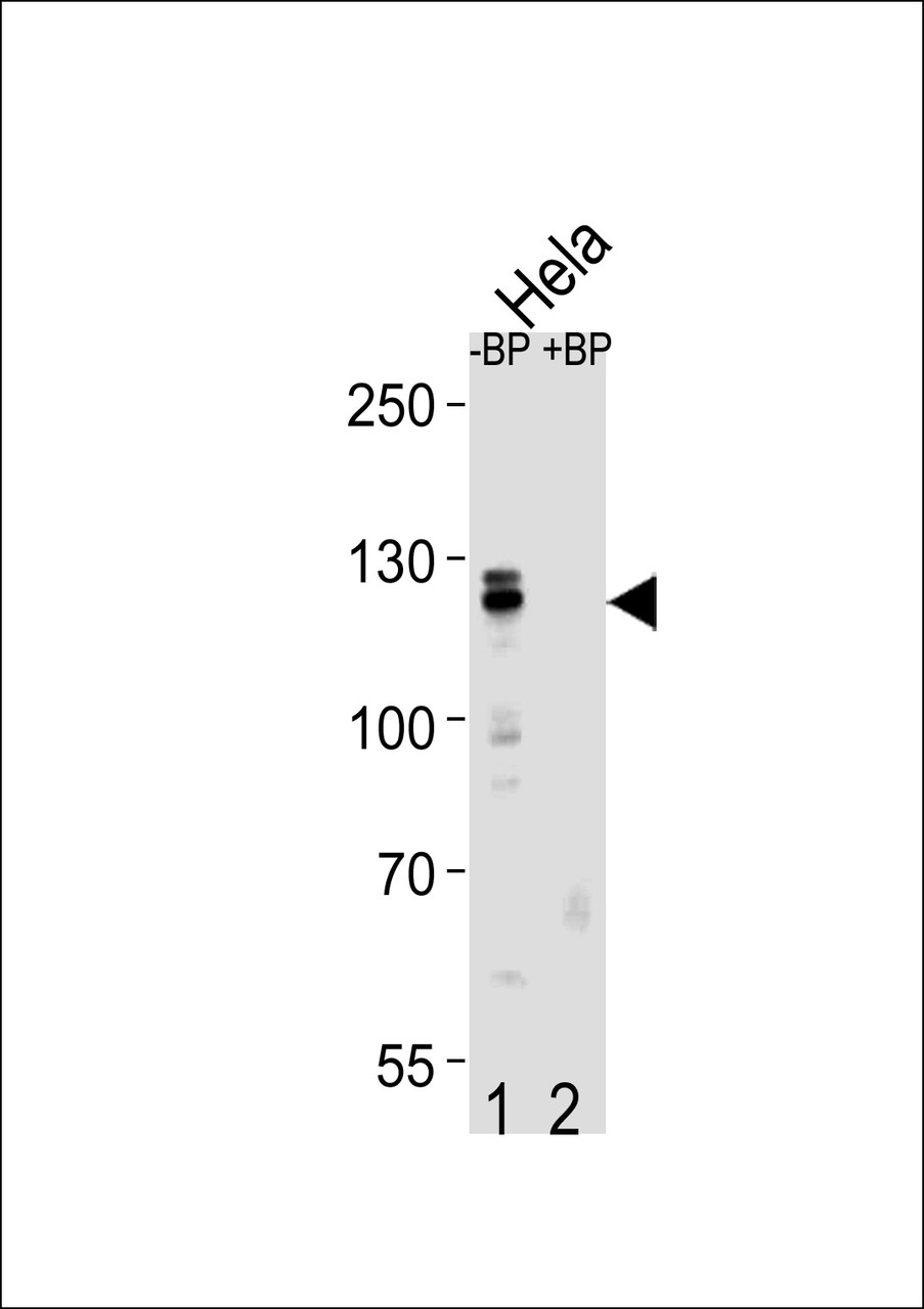 Western blot analysis of CUL4B Antibody Pab pre-incubated without (lane 1) and with (lane 2) blocking peptide in Hela cell line lysate.