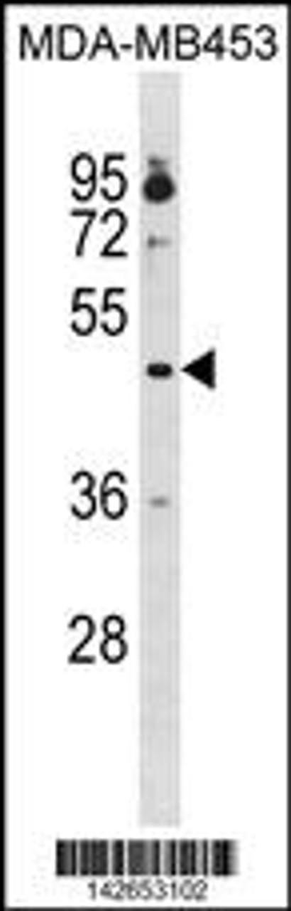 Western blot analysis in MDA-MB453 cell line lysates (35ug/lane) .