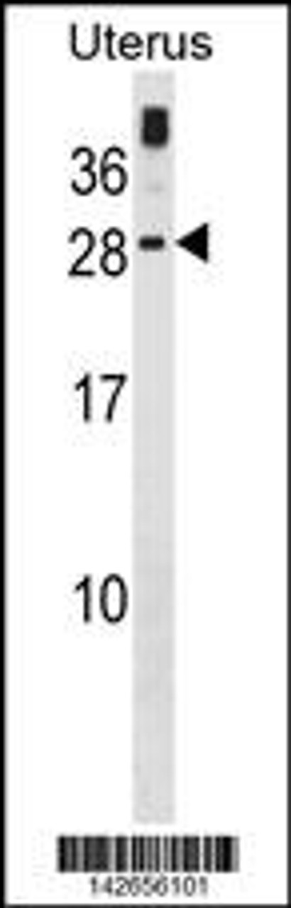 Western blot analysis in human Uterus tissue lysates (35ug/lane) .