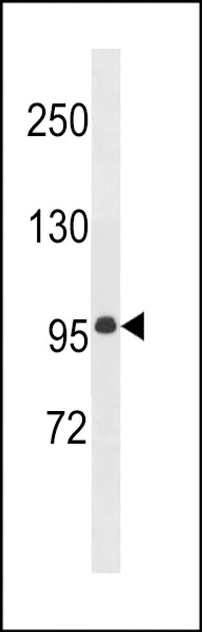 Western blot analysis in mouse bladder tissue lysates (35ug/lane) .