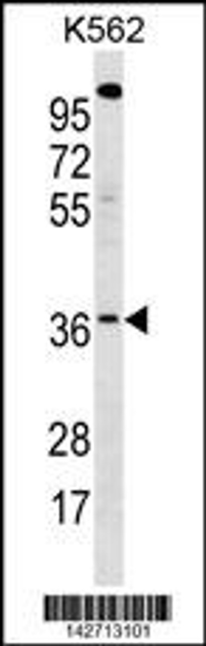 Western blot analysis in K562 cell line lysates (35ug/lane) .