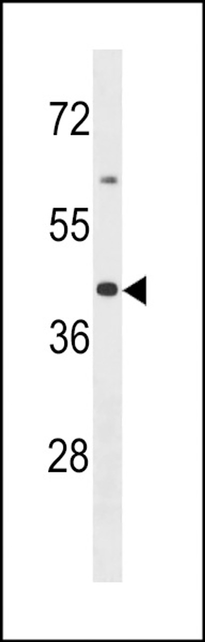 Western blot analysis in MDA-MB453 cell line lysates (35ug/lane) .