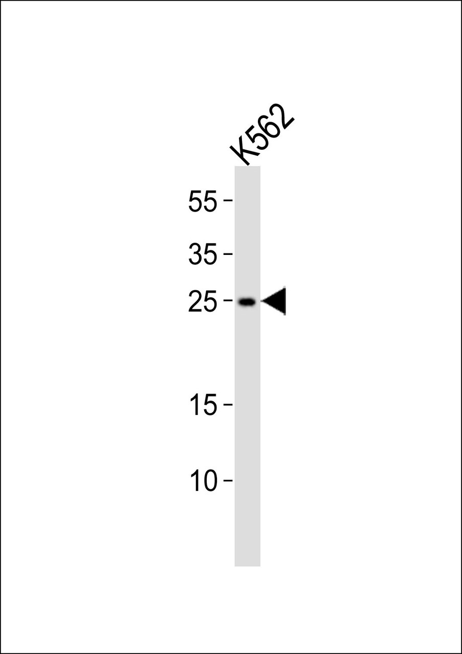 Western blot analysis of lysate from K562 cell line, using RAB27A Antibody at 1:1000.