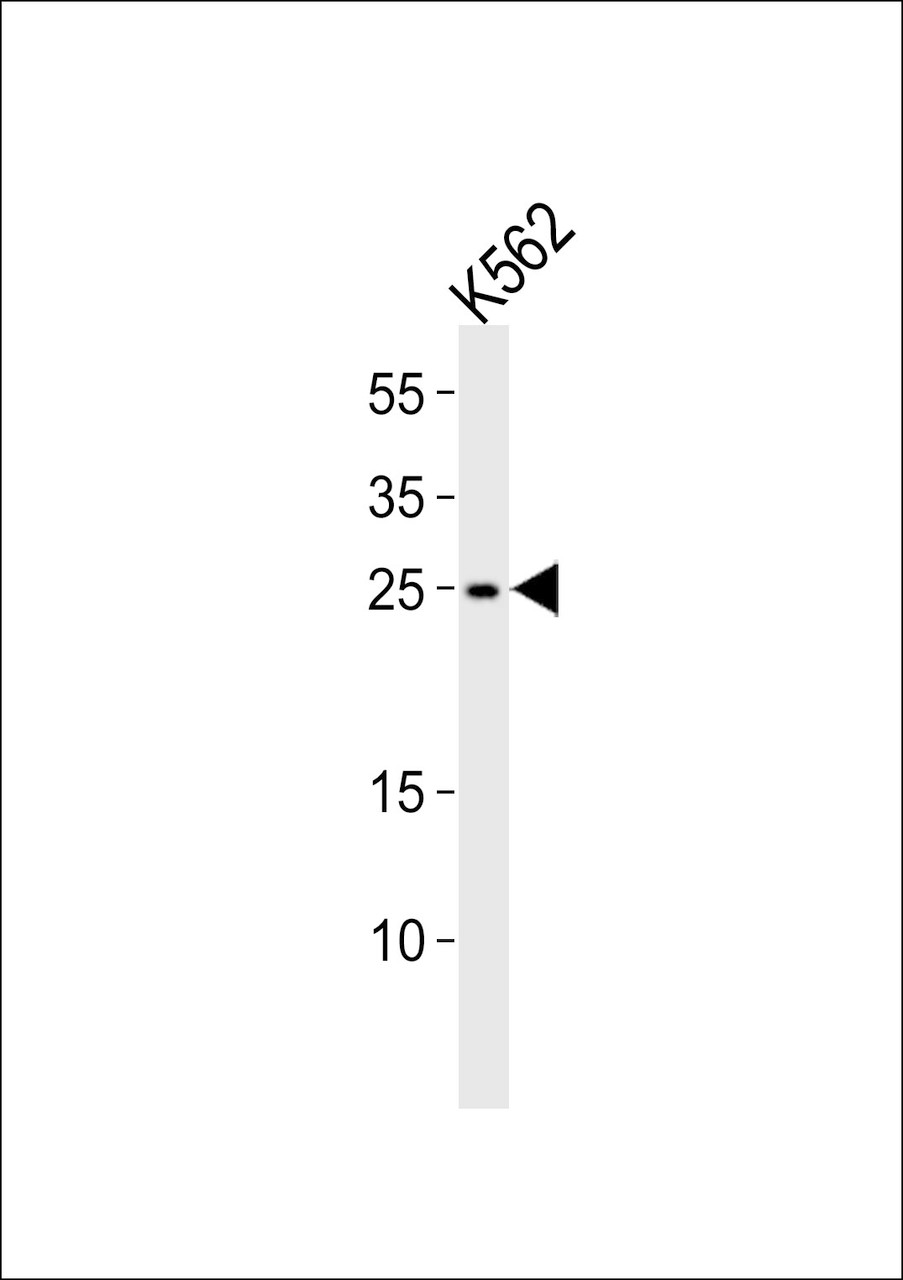 Western blot analysis of lysate from K562 cell line, using RAB27A Antibody at 1:1000.