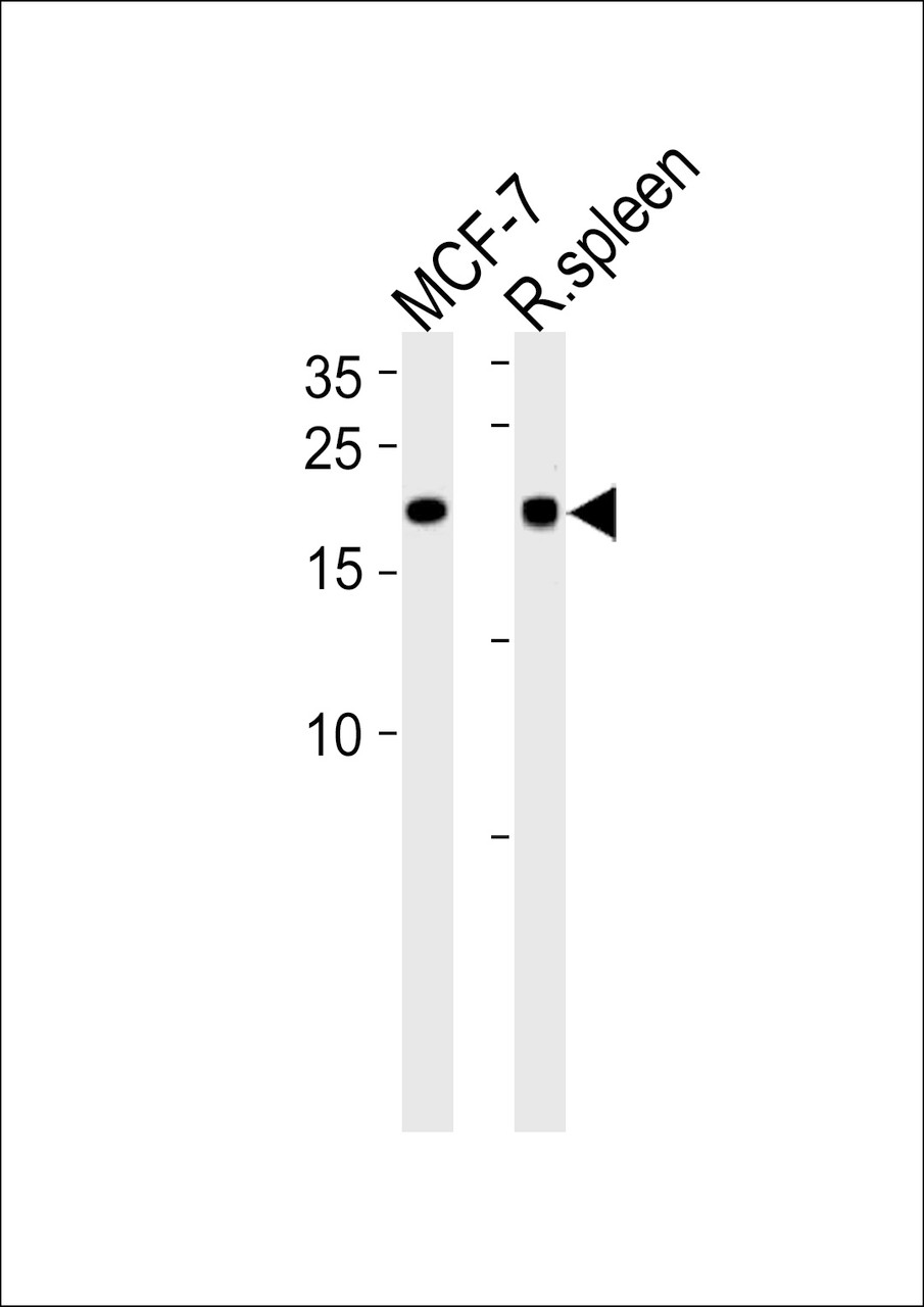 Western blot analysis in MCF-7 cell line and rat spleen tissue lysates (35ug/lane) .