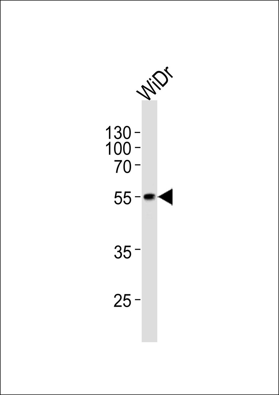 Western blot analysis of lysate from WiDr cell line, using hPDX1R444 at 1:1000 at each lane.