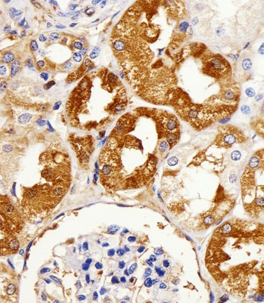 Immunohistochemical analysis of paraffin-embedded H.kidney section using LIMK2 Antibody . Antibody was diluted at 1:25 dilution. A peroxidase-conjugated goat anti-rabbit IgG at 1:400 dilution was used as the secondary antibody, followed by DAB staining.