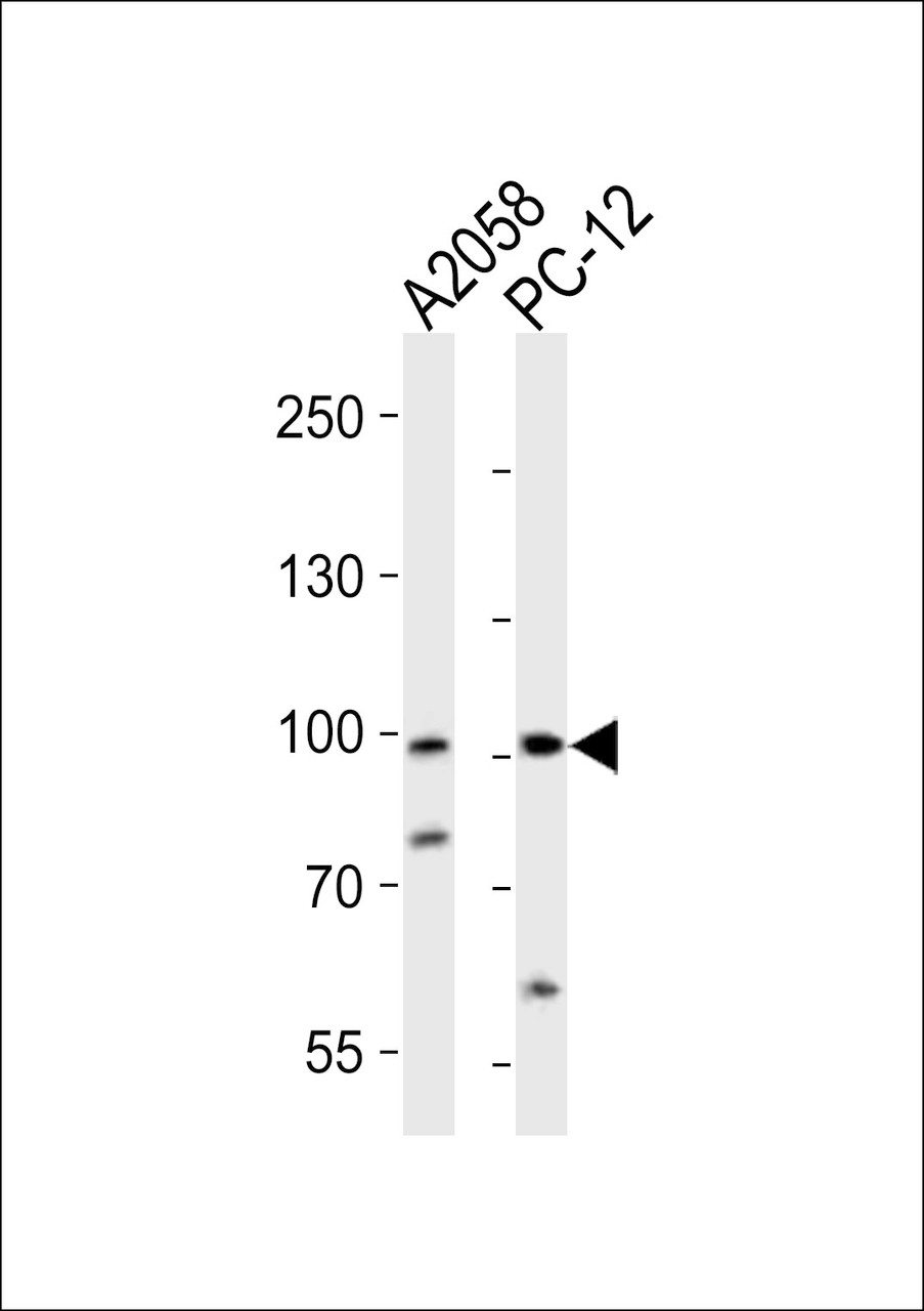 Western blot analysis of lysates from A2058, rat PC-12 cell line (from left to right) , using PROX1 Antibody at 1:1000 at each lane.