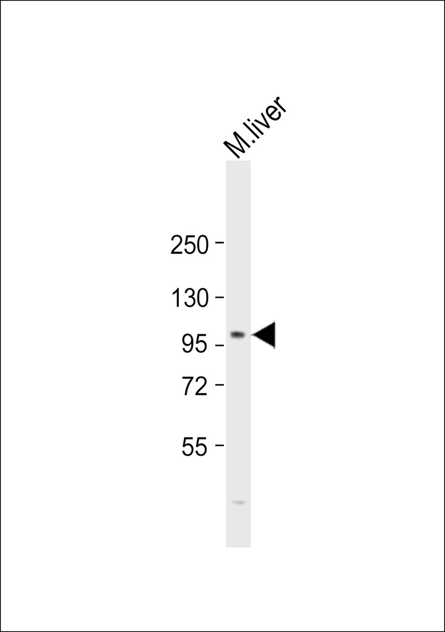 Western Blot at 1:2000 dilution + mouse liver lysate Lysates/proteins at 20 ug per lane.