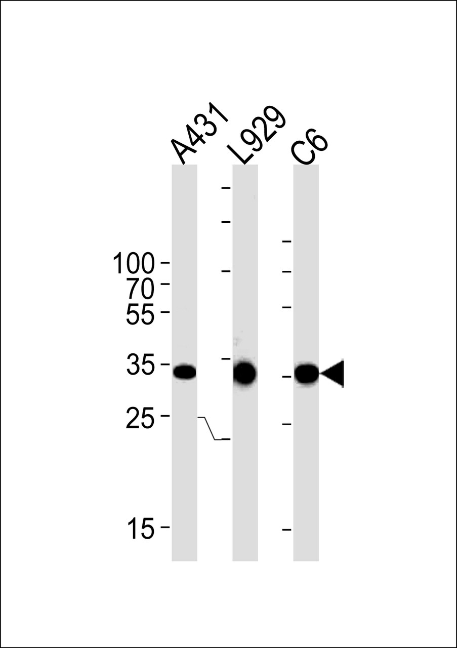 Western blot analysis in A431, mouse L929, rat C6 cell line lysates (35ug/lane) .This demonstrates the CCND1 antibody detected the CCND1 protein (arrow) .