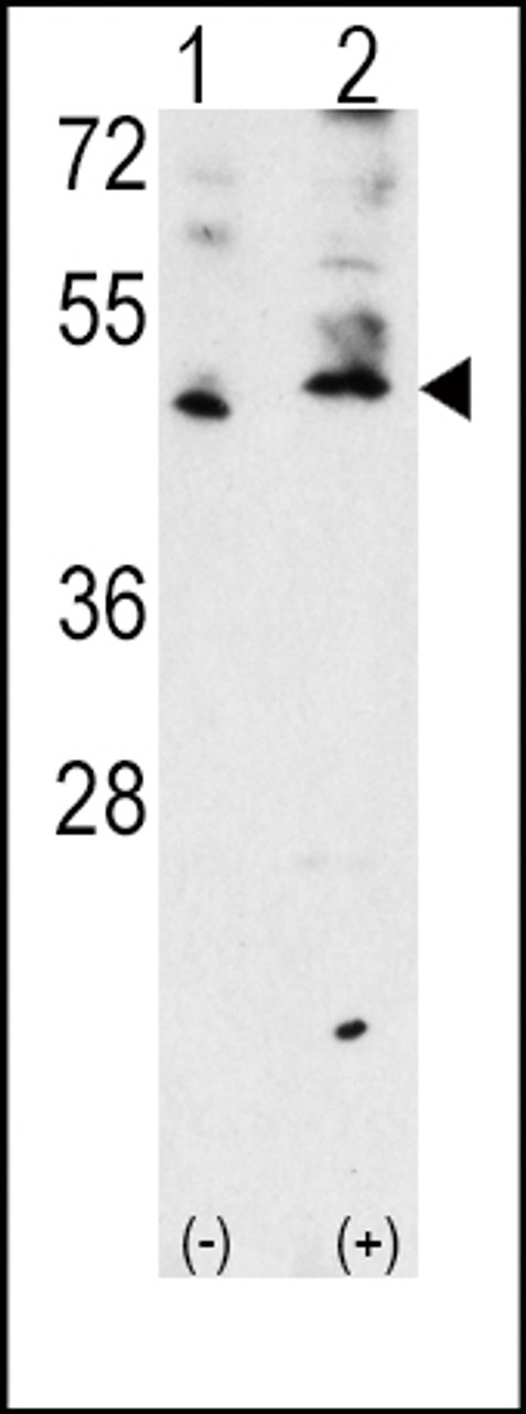 Western blot analysis of VEGF3 Antibody polyclonal antibody using 293 cell lysates (2 ug/lane) either nontransfected (Lane 1) or transiently transfected with the VEGF3 gene (Lane 2) .