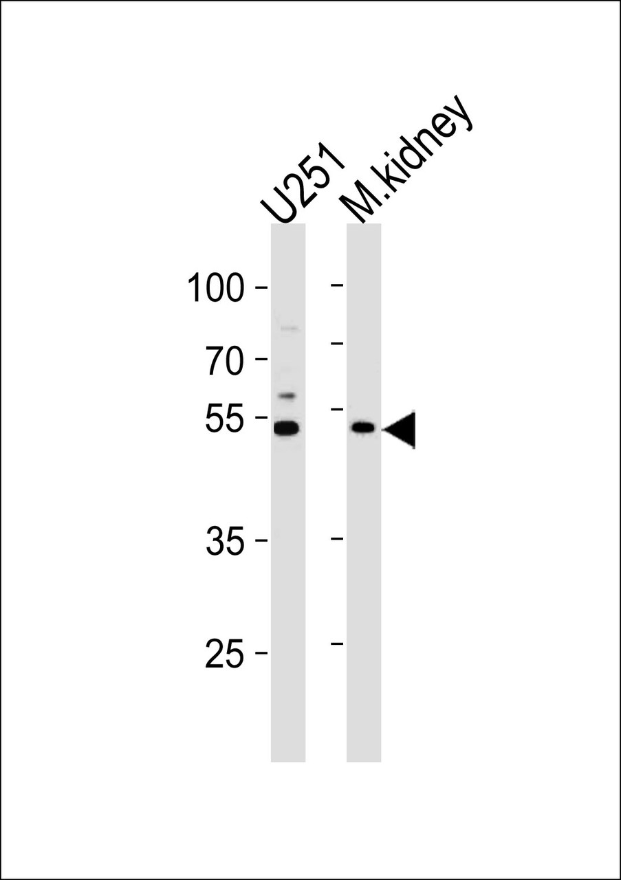 Western blot analysis in U251 cell line and mouse kidney lysates (35ug/lane) .