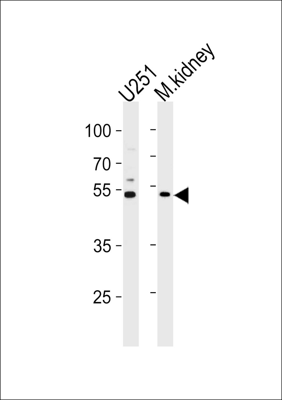 Western blot analysis in U251 cell line and mouse kidney lysates (35ug/lane) .