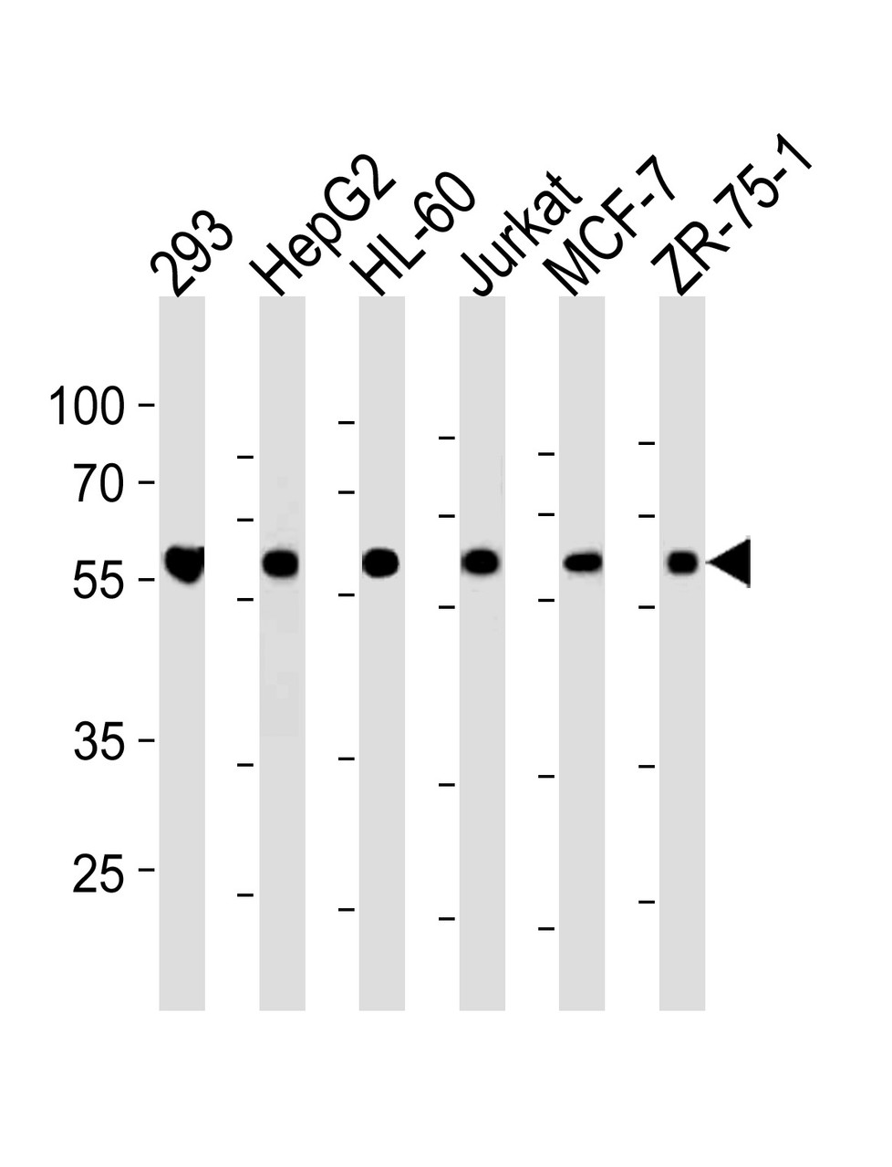 Western blot analysis in 293, HepG2, HL-60, Jurkat, MCF-7, ZR-75-1 cell line lysates (35ug/lane) .