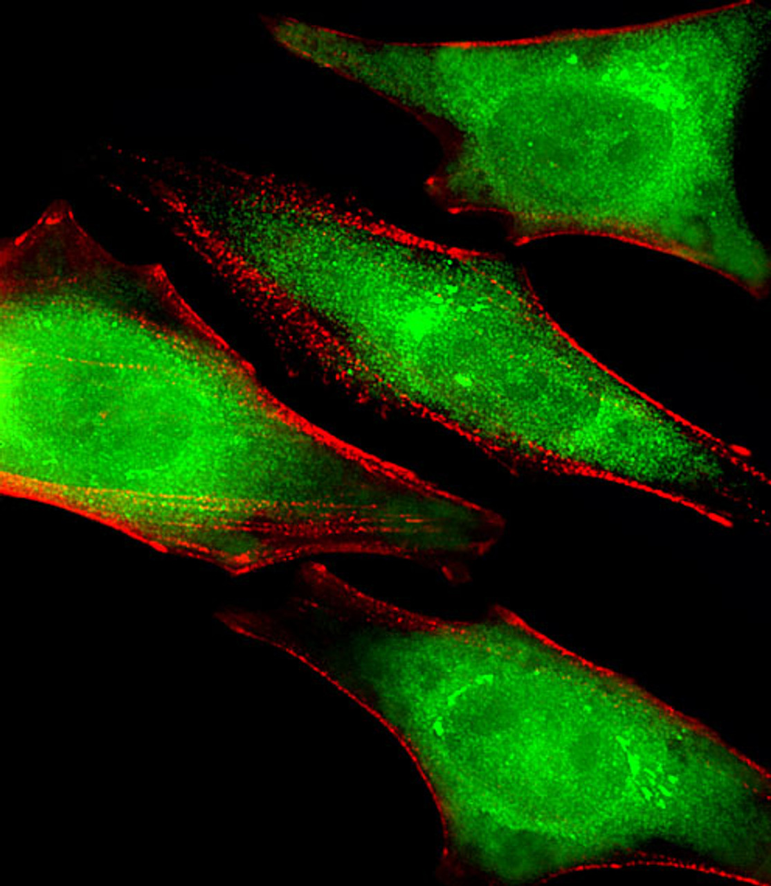 Fluorescent image of Hela cells stained with PRS4 Antibody . Antibody was diluted at 1:25 dilution. An Alexa Fluor 488-conjugated goat anti-rabbit lgG at 1:400 dilution was used as the secondary antibody (green) . Cytoplasmic actin was counterstained with Alexa Fluor 555 conjugated with Phalloidin (red) .