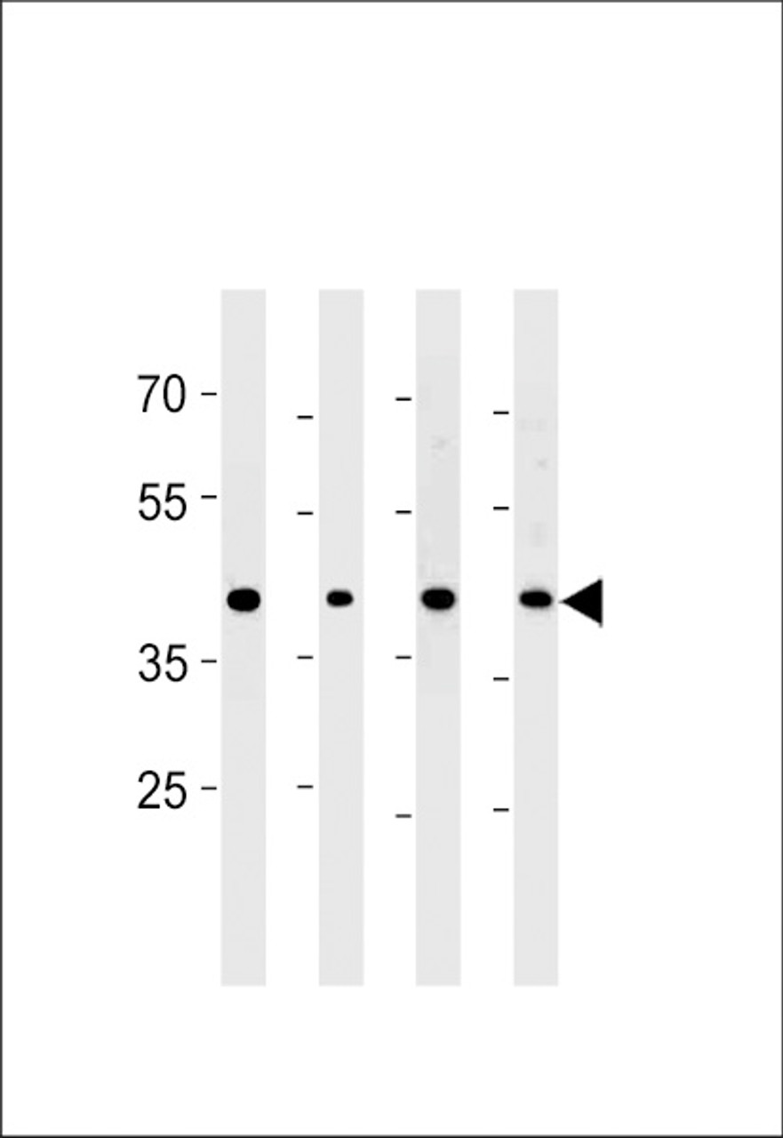 Western blot analysis in PC-3 cell line and mouse brain, testis and liver lysates (35ug/lane) .