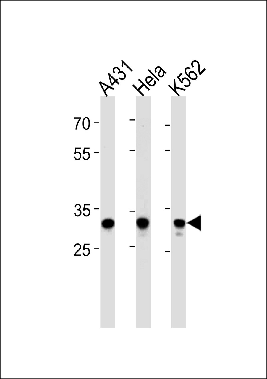 Western blot analysis in A431, Hela, K562 cell line lysates (35ug/lane) .