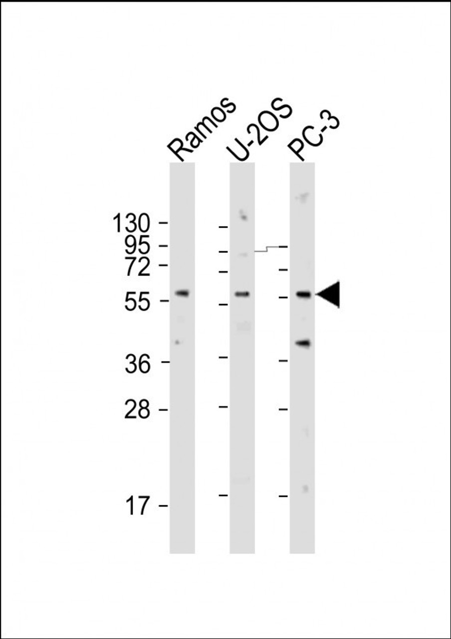 Western Blot at 1:2000 dilution Lane 1: Ramos whole cell lysate Lane 2: U-2OS whole cell lysate Lane 3: PC-3 whole cell lysate Lysates/proteins at 20 ug per lane.