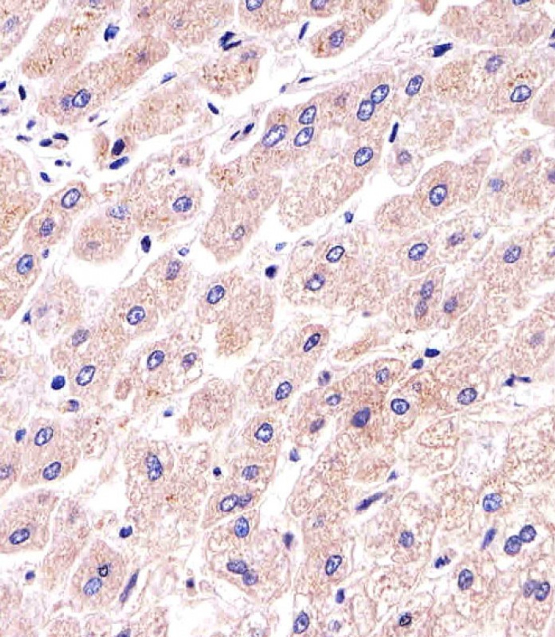 Immunohistochemical analysis of paraffin-embedded H. liver section using PPP2R2A Antibody (N-term) . Antibody was diluted at 1:25 dilution. A undiluted biotinylated goat polyvalent antibody was used as the secondary, followed by DAB staining.