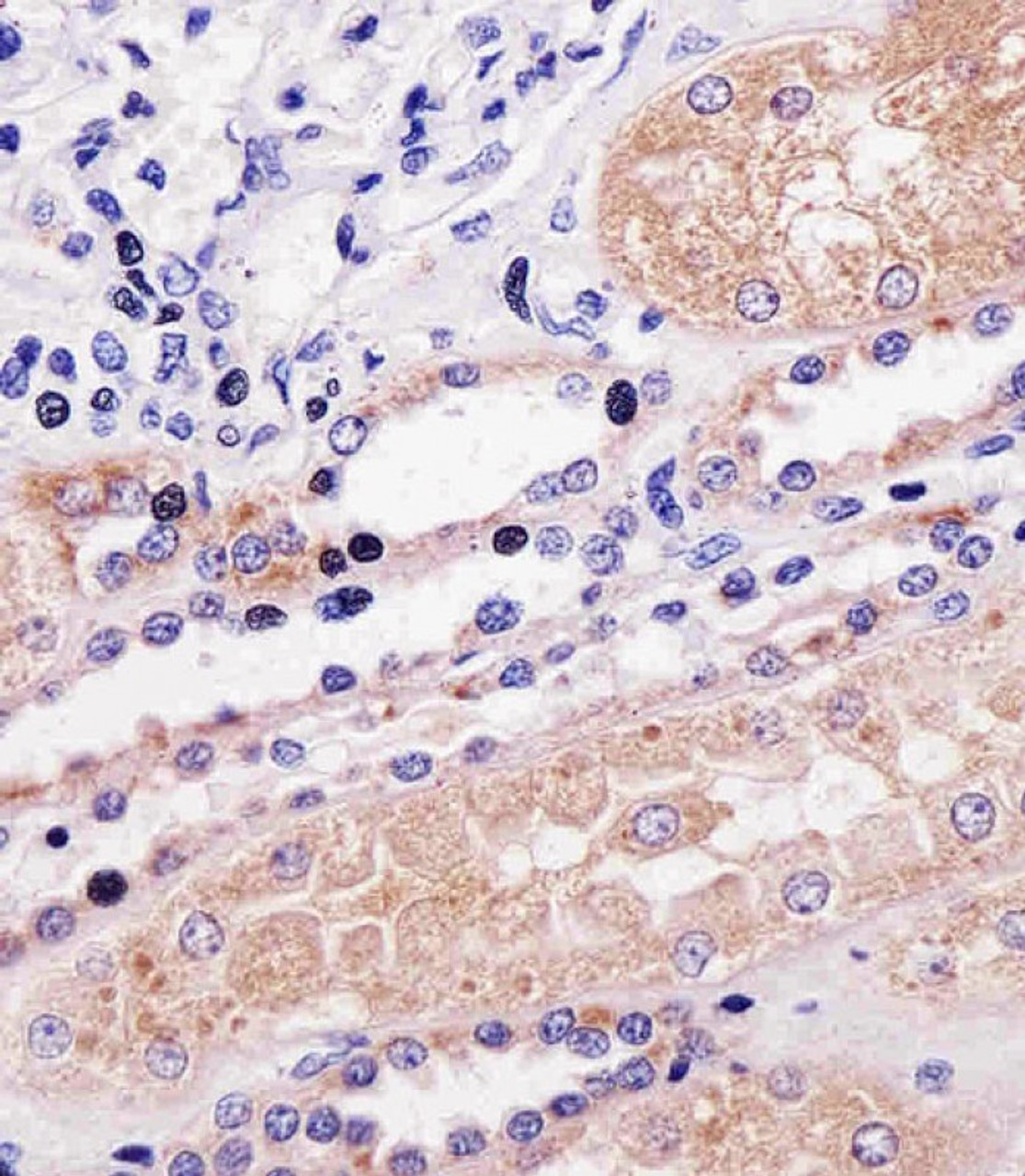 Immunohistochemical analysis of paraffin-embedded H. kidney section using PPP2R2A Antibody (N-term) . Antibody was diluted at 1:25 dilution. A undiluted biotinylated goat polyvalent antibody was used as the secondary, followed by DAB staining.