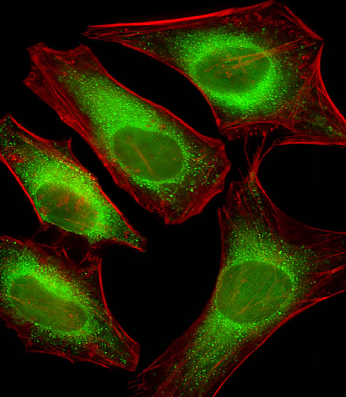 Fluorescent image of Hela cells stained with USP51 Antibody . Antibody was diluted at 1:25 dilution. An Alexa Fluor 488-conjugated goat anti-rabbit lgG at 1:400 dilution was used as the secondary antibody (green) . Cytoplasmic actin was counterstained with Alexa Fluor 555 conjugated with Phalloidin (red) .