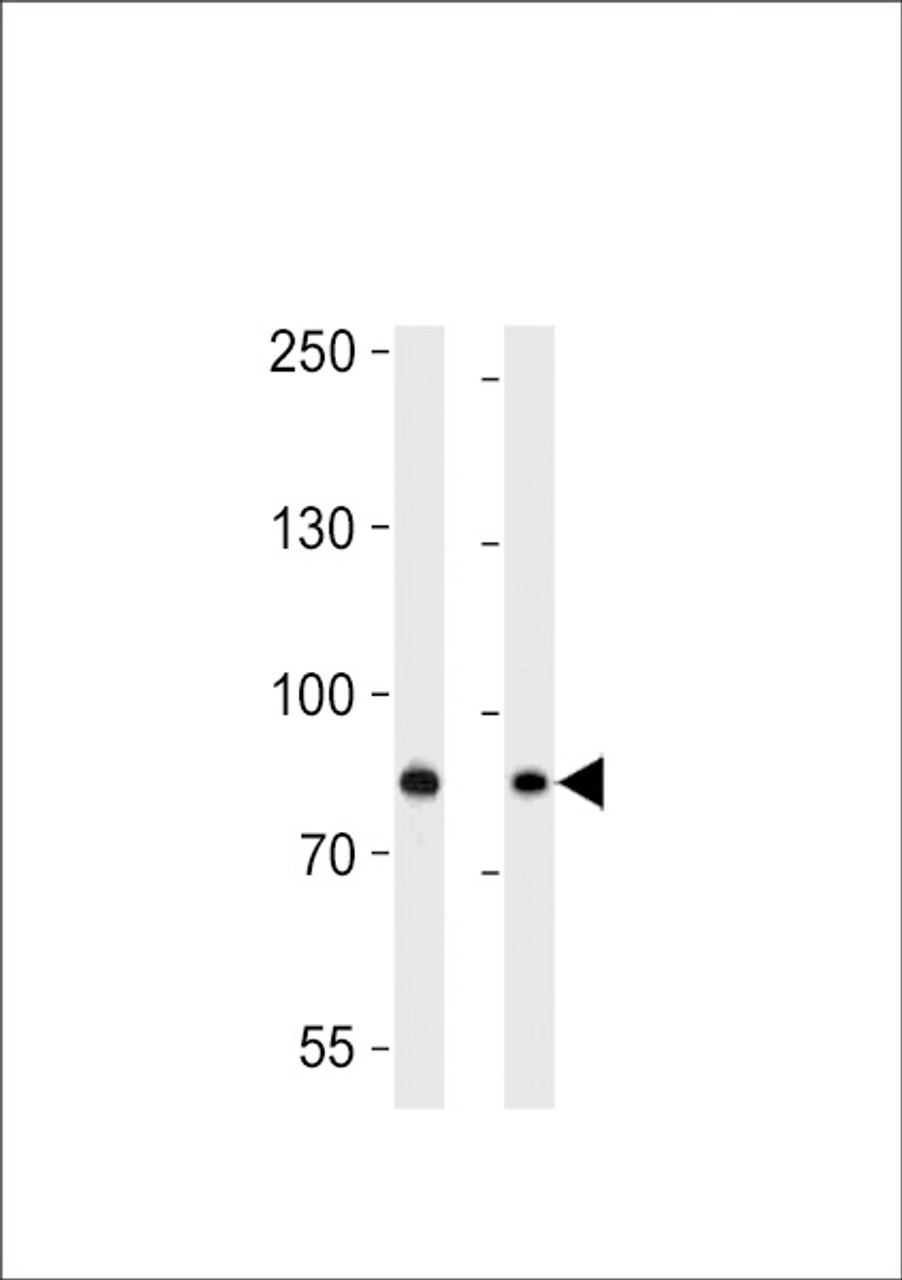 Western blot analysis in HepG2, MCF-7 cell line lysates (35ug/lane) .