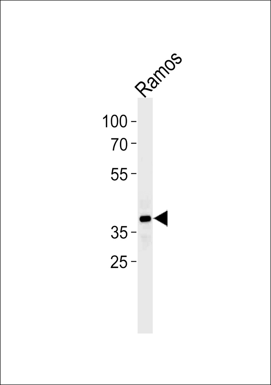 Western blot analysis of lysate from Ramos cell line, using PHF11 Antibody at 1:1000 at each lane. A goat anti-rabbit (HRP) at 1:5000 dilution was used as the secondary antibody. Lysate at 35ug.