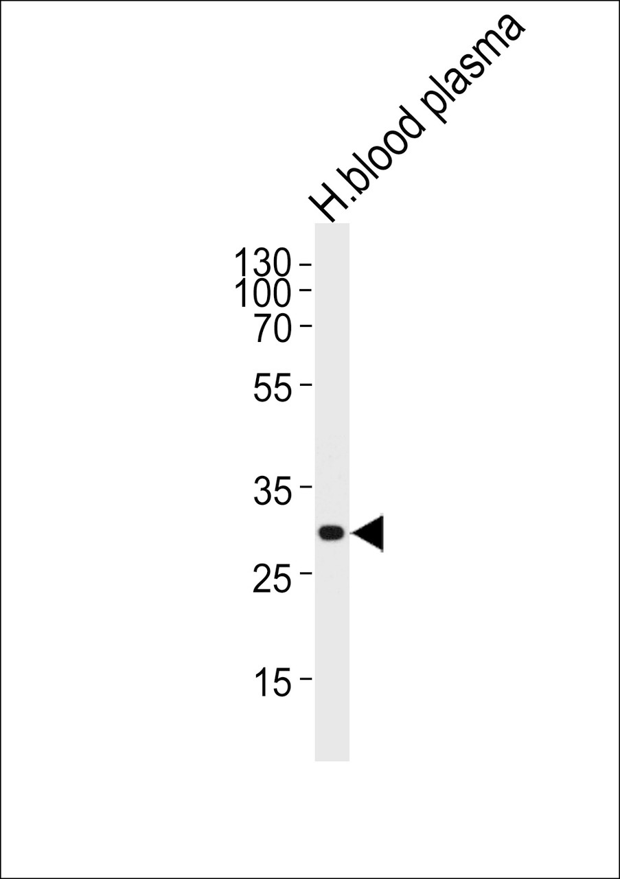 Western blot analysis of lysate from human blood plasma tissue lysate, using C1QA Antibody .