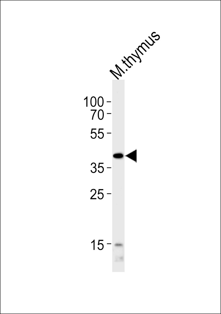 Western blot analysis of lysate from mouse thymus tissue lysate, using Mouse Tfap2a Antibody at 1:1000 at each lane.