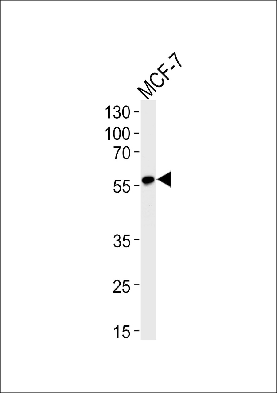 Western blot analysis of lysate from MCF-7 cell line, using ACVRL1 Antibody at 1:1000.