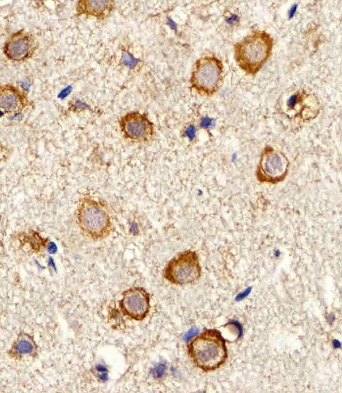 Immunohistochemical analysis of paraffin-embedded M.brain section using MYH14 Antibody . Antibody was diluted at 1:25 dilution. A peroxidase-conjugated goat anti-rabbit IgG at 1:400 dilution was used as the secondary antibody, followed by DAB staining.