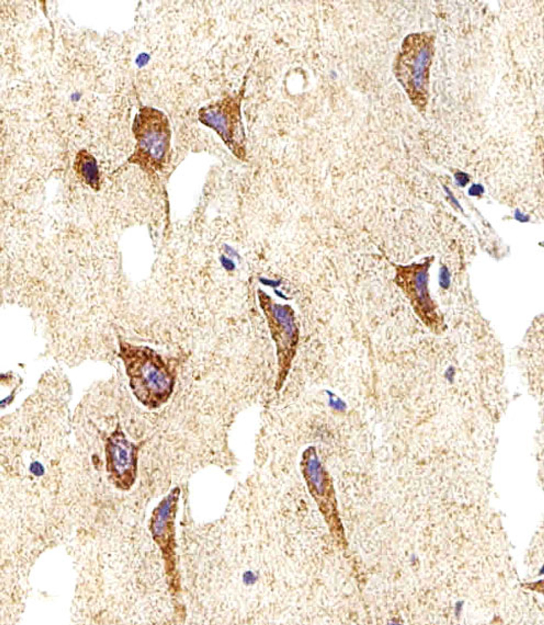 Immunohistochemical analysis of paraffin-embedded H.brain section using MYH14 Antibody . Antibody was diluted at 1:25 dilution. A peroxidase-conjugated goat anti-rabbit IgG at 1:400 dilution was used as the secondary antibody, followed by DAB staining.