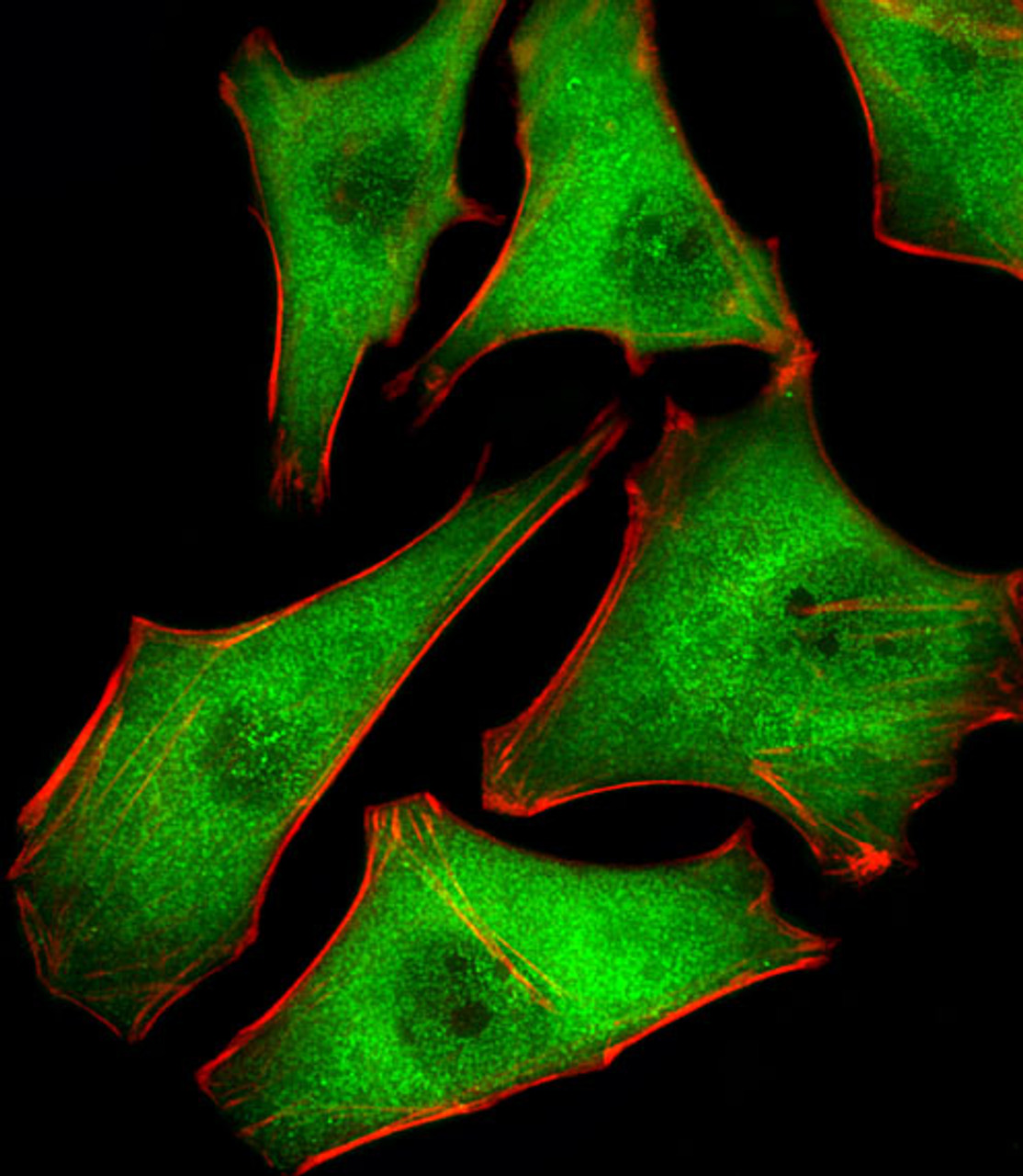 Fluorescent image of Hela cells stained with PSMD10 Antibody . Antibody was diluted at 1:25 dilution. An Alexa Fluor 488-conjugated goat anti-rabbit lgG at 1:400 dilution was used as the secondary antibody (green) . Cytoplasmic actin was counterstained with Alexa Fluor 555 conjugated with Phalloidin (red) .