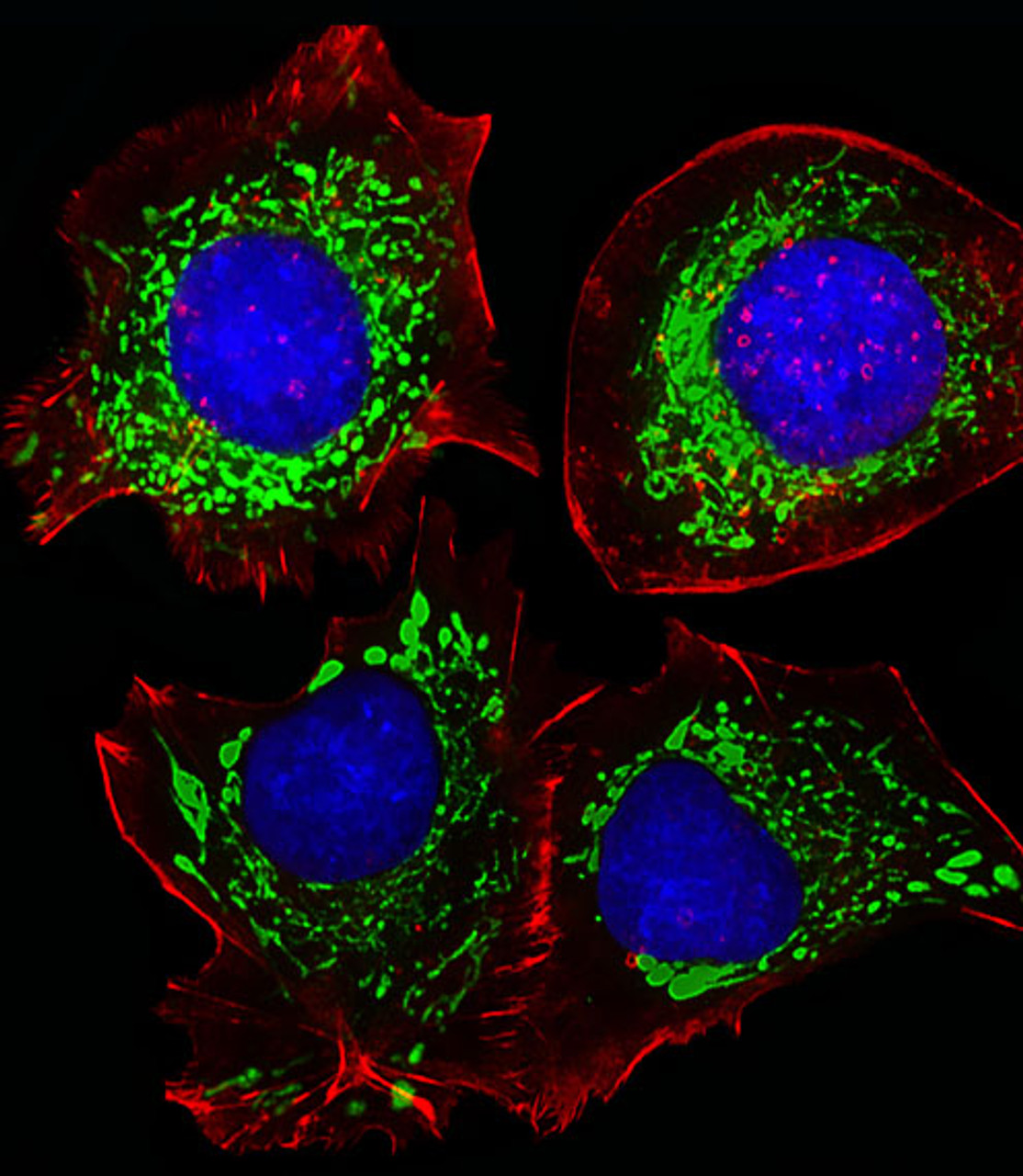 Fluorescent image of HepG2 cells stained with AK4 Antibody . Antibody was diluted at 1:25 dilution. An Alexa Fluor 488-conjugated goat anti-rabbit lgG at 1:400 dilution was used as the secondary antibody (green) . DAPI was used to stain the cell nuclear (blue) . Cytoplasmic actin was counterstained with Alexa Fluor 555 conjugated with Phalloidin (red) .