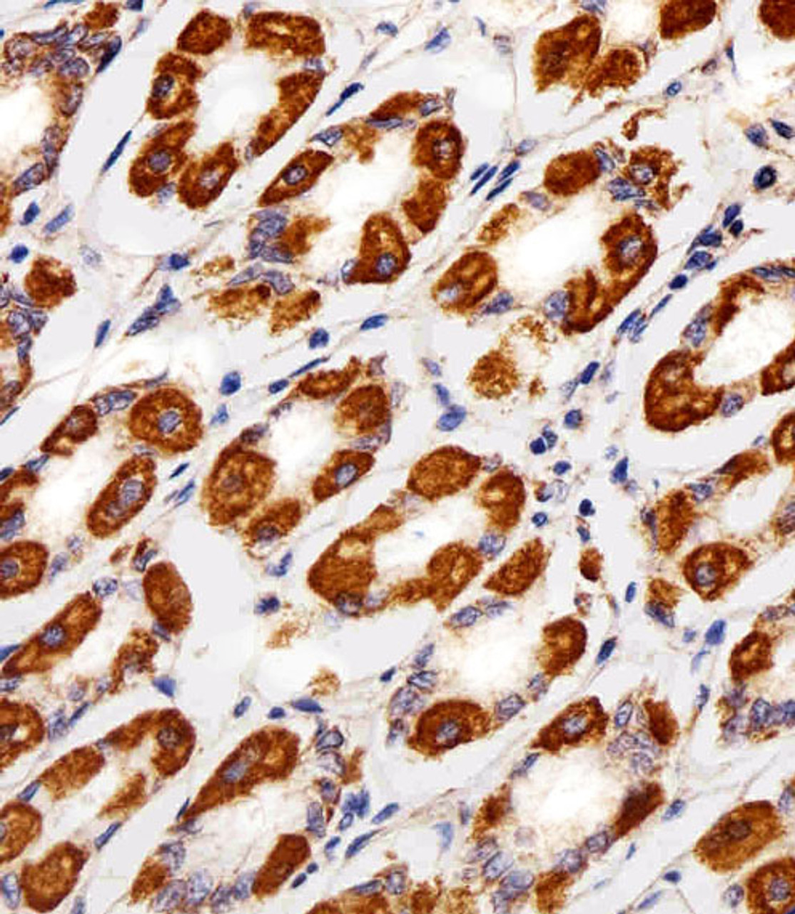 Immunohistochemical analysis of paraffin-embedded H. stomach section using CYC1 Antibody . Antibody was diluted at 1:25 dilution. A peroxidase-conjugated goat anti-rabbit IgG at 1:400 dilution was used as the secondary antibody, followed by DAB staining.
