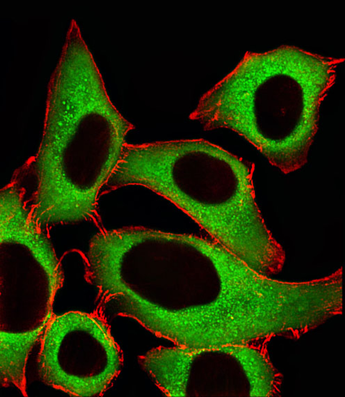 Fluorescent image of A549 cells stained with ALDH1A1 Antibody . AP20580c was diluted at 1:25 dilution. An Alexa Fluor 488-conjugated goat anti-rabbit lgG at 1:400 dilution was used as the secondary antibody (green) . Cytoplasmic actin was counterstained with Alexa Fluor 555 conjugated with Phalloidin (red) .