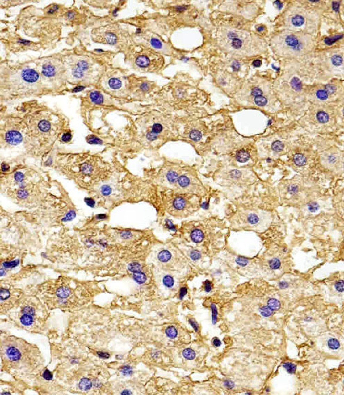 Immunohistochemical analysis of paraffin-embedded H. liver section using HBG2 Antibody . Antibody was diluted at 1:100 dilution. A peroxidase-conjugated goat anti-rabbit IgG at 1:400 dilution was used as the secondary antibody, followed by DAB staining.