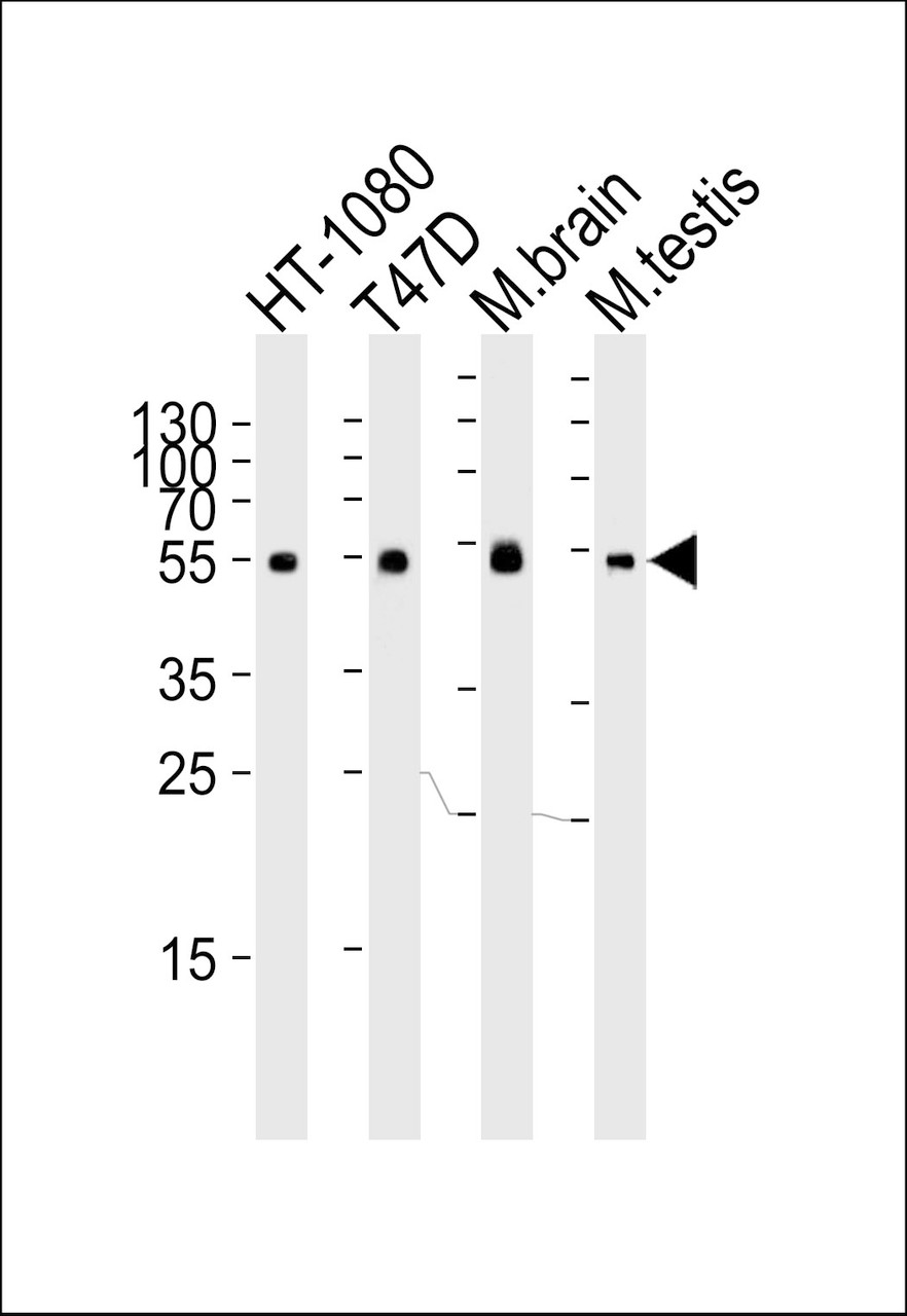 Western blot analysis of lysates from HT-1080, T47D cell line, mouse brain and testis tissue lysate (from left to right) , using TUBA1C Antibody at 1:1000 at each lane.