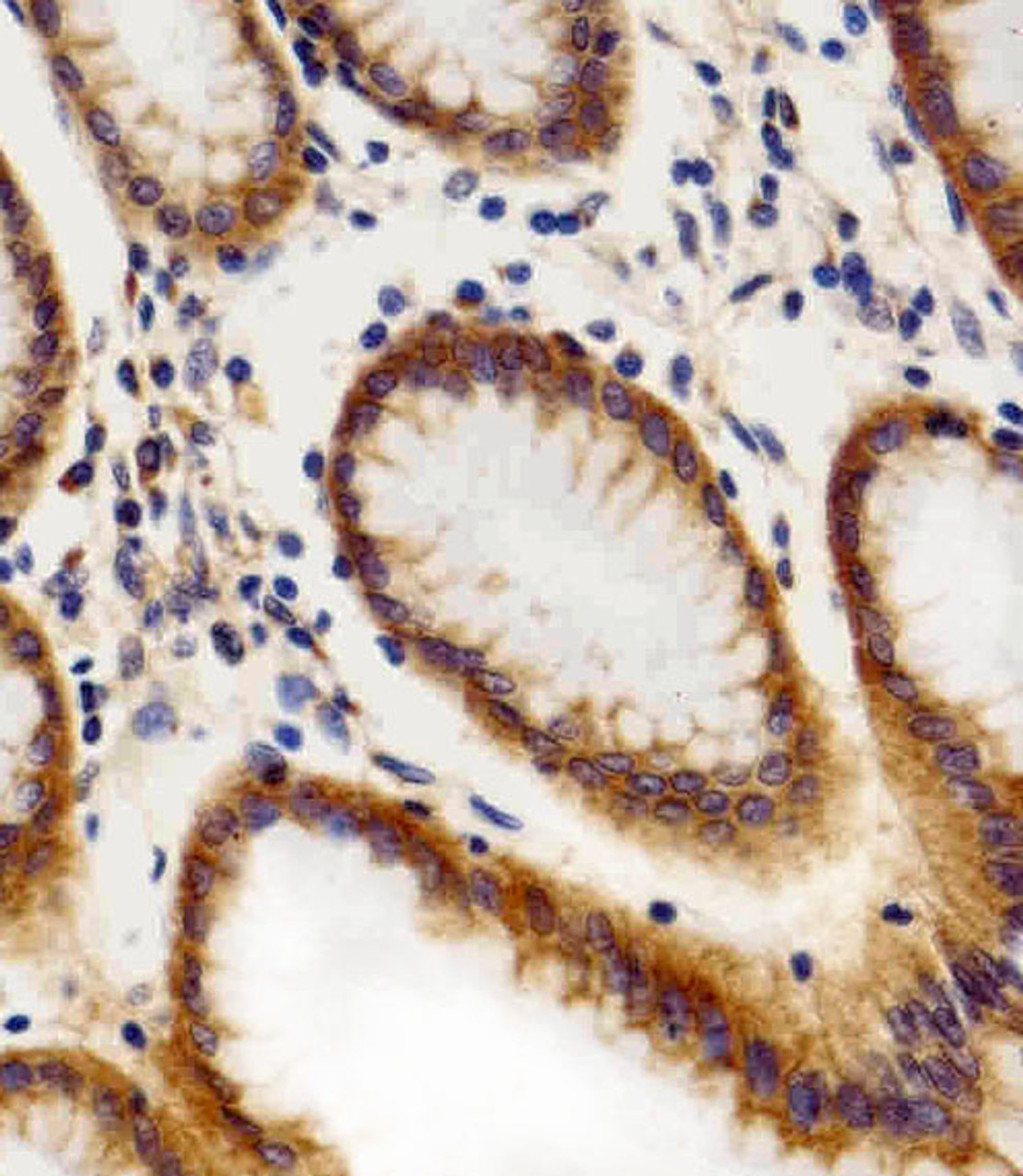 Immunohistochemical analysis of paraffin-embedded H. stomach section using CHML Antibody . Antibody was diluted at 1:100 dilution. A peroxidase-conjugated goat anti-rabbit IgG at 1:400 dilution was used as the secondary antibody, followed by DAB staining.