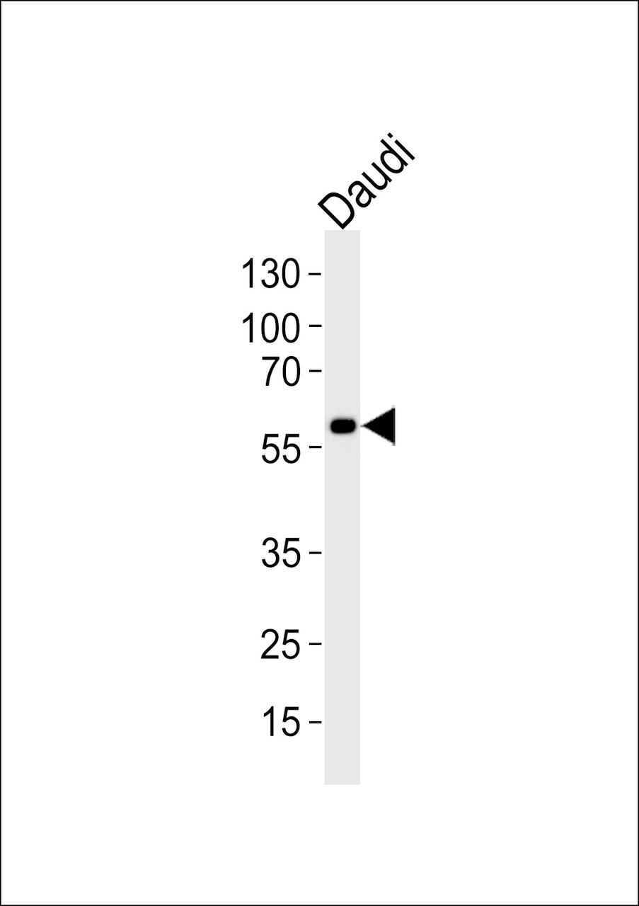 Western blot analysis of lysate from Daudi cell line, using CHRNA9 Antibody at 1:1000.