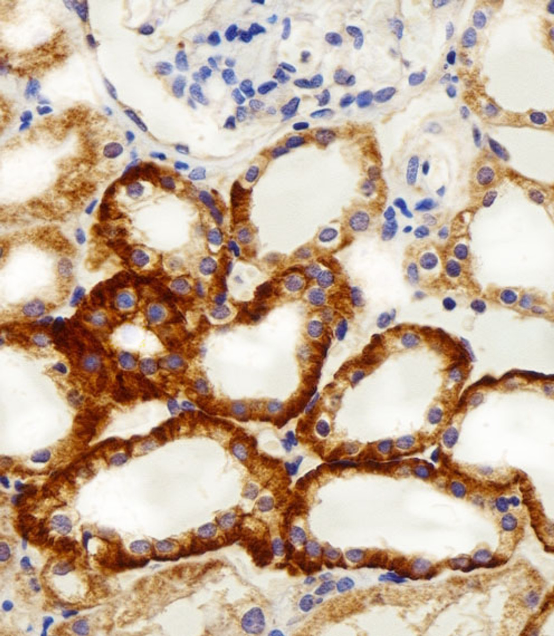 Immunohistochemical analysis of paraffin-embedded H. kidney section using NDUFC2 Antibody (N-term) . Antibody was diluted at 1:100 dilution. A peroxidase-conjugated goat anti-rabbit IgG at 1:400 dilution was used as the secondary antibody, followed by DAB staining.