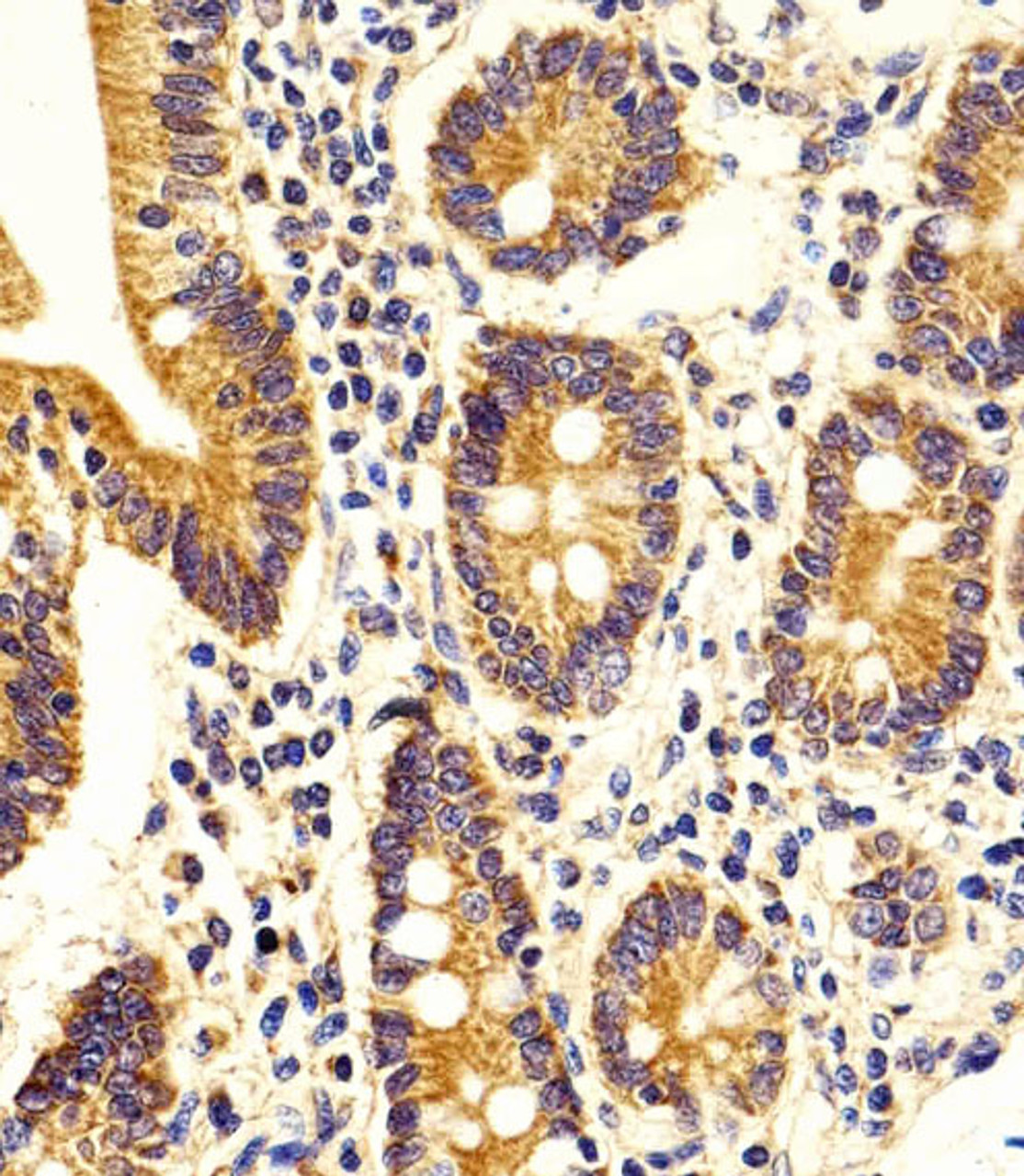 Immunohistochemical analysis of paraffin-embedded H. duodenum section using STRADA Antibody . Antibody was diluted at 1:100 dilution. A peroxidase-conjugated goat anti-rabbit IgG at 1:400 dilution was used as the secondary antibody, followed by DAB staining.