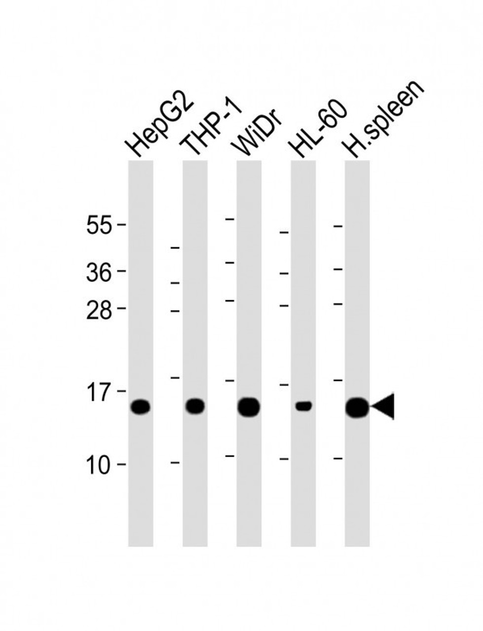 Western Blot at 1:2000 dilution Lane 1: HepG2 whole cell lysate Lane 2: THP-1 whole cell lysate Lane 3: WiDr whole cell lysate Lane 4: HL-60 whole cell lysate Lane 5: Human spleen lysate Lysates/proteins at 20 ug per lane.