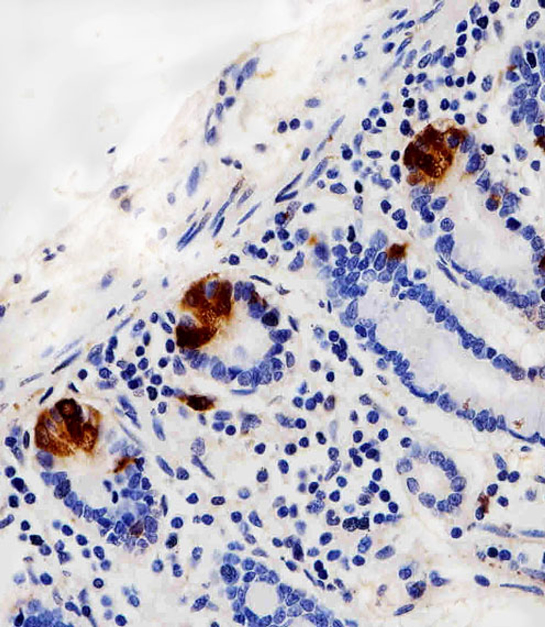 Immunohistochemical analysis of paraffin-embedded H. small intestine section using LYZ Antibody . Antibody was diluted at 1:100 dilution. A peroxidase-conjugated goat anti-rabbit IgG at 1:400 dilution was used as the secondary antibody, followed by DAB staining.