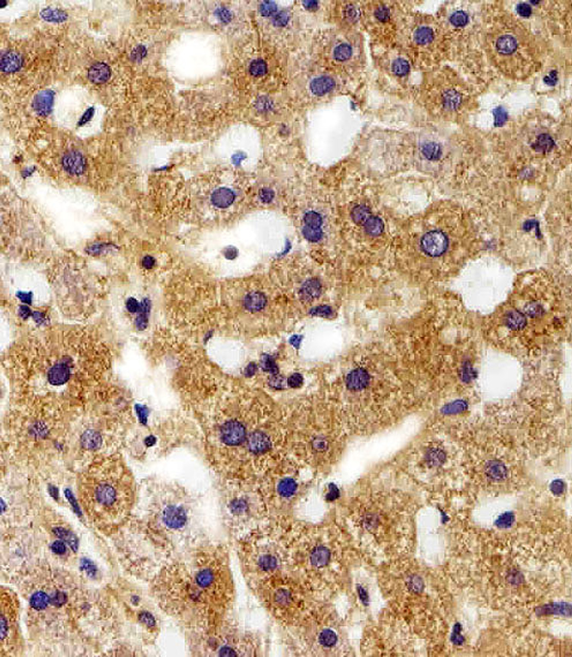 Immunohistochemical analysis of paraffin-embedded H. liver section using FXYD6 Antibody . Antibody was diluted at 1:100 dilution. A peroxidase-conjugated goat anti-rabbit IgG at 1:400 dilution was used as the secondary antibody, followed by DAB staining.