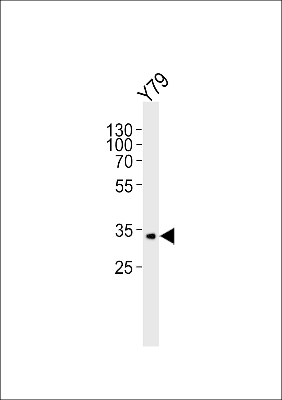 Western blot analysis of lysate from Y79 cell line, using CRX Antibody at 1:1000.